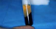 Bone growth factor
