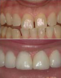 cosmetic dentaires